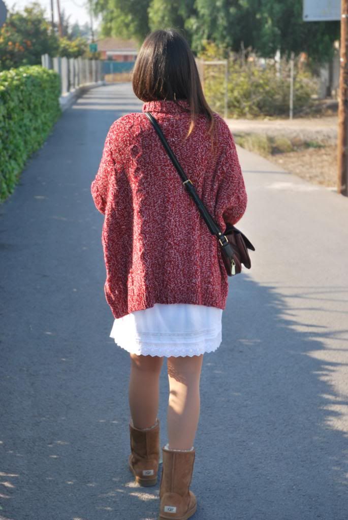 Ugg Outfit StreetStyle