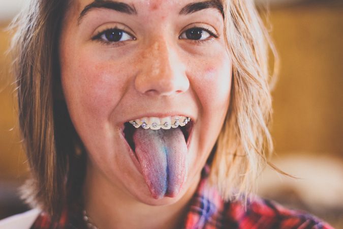 b-blue-tongue