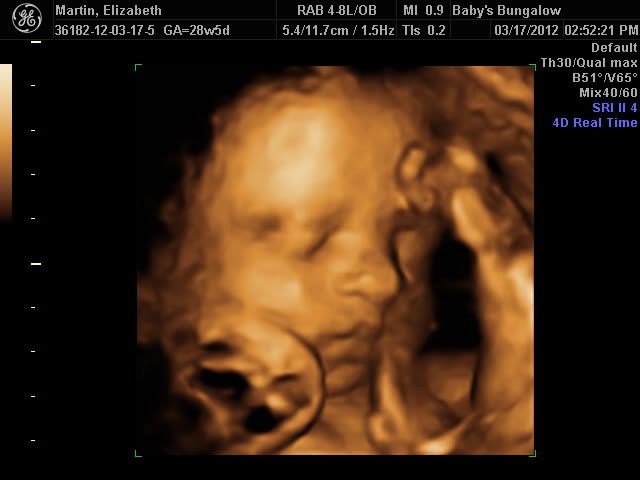 4d ultrasound pics week 23-26 - BabyGaga